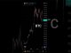BTC 7 August 2024 TODAY MY PRICE PREDICTION #shorts #youtubeshorts #trading #crypto #bitcoin #viral