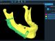 #AI-based segmentation, 3D modelling and Cutting Guides for Maxillofacial Surgical Applications