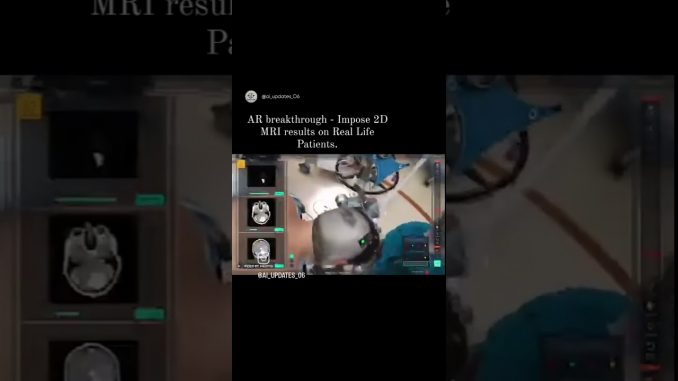 Ai operation #ai #vr #news #tech